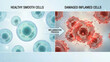 © Medical Comparisons - Cellular Inflammation Process and Damaged Inflamed Cells