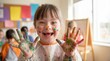 © Artem Zatsepilin - happy caucasian girl with down syndrome showing painted palms in art class. child with disability laughing with colorful hands. kindergarten education, creativity concept. poster, brochure.