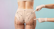 © Shoaib - Young woman in Gray pink underwear with marks on her body against lilac background, back view. Liposuction concept