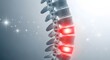 © designdio - Lumbar spine injury and degenerative disc disease. Chiropractic adjustment and pain management. Skeletal back view with glowing red inflammation on lower vertebral segments
