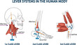 © MstSufia - Anatomy diagram illustrating first second and third class lever systems in the human body showing muscle effort force load and fulcrum point for education