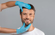 © Prostock-studio - Handsome middle-aged man with pencil marks on skin for cosmetic surgery, ready for operation. Aesthetic Cosmetology concept. Plastic surgeon touching smiling man face before surgery, grey background