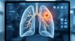 © Bilal - Lung with cancerous tumor highlighted on medical screen