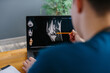 © dsheremeta - Doctor analyzing knee mri scan diagnosis on laptop