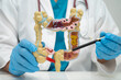 © Warawan - Intestine, doctor holding human model in hospital.