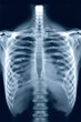 © Yeamin - Human skeleton torso bones xray image of ribcage and spine transparent background