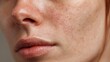 © LimeSky - Close up of a woman s face highlighting skin issues like dryness acne wrinkles and other flaws focusing on rejuvenation and hydration