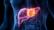 © vladim_ka - Visualization shows glowing tumor mass in pancreas area to highlight pancreatic cancer effects on the body