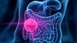 © vladim_ka - System oncology concept art highlights cancer and its effects on the human body with a focus on the digestive system and internal organs