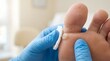 © Unimaginable Pic - Healthcare professional treating painful blister and hard skin callus on patient foot using cotton pad in clinic