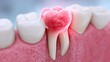 © Jayk - Close-up 3D render of a painful, inflamed tooth with visible roots and surrounding gum tissue