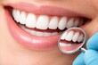 © Alamin - Healthy white teeth shown in dental mirror with perfect smile close up detail
