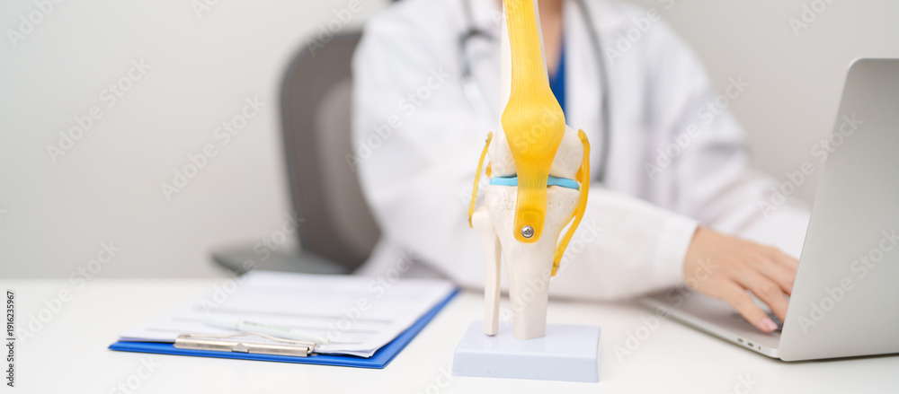 Doctor with Human Knee joint anatomy model. Osteoarthritis ...