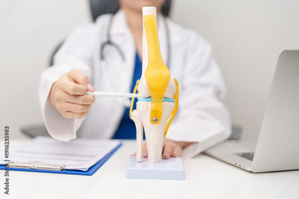 Doctor with Human Knee joint anatomy model. Osteoarthritis ...