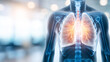 © Bonsales - Human torso x ray scan with glowing lungs. Respiratory system illustration displaying pneumonia, lung health, and illness concept