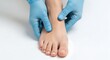 © Citra - Medical professional examining bare human foot.
