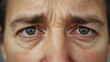 © siraphol - Tired brown eyes close up with wrinkles and furrowed brow conveying fatigue