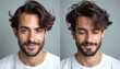 © Maryna - Man shows hair growth progress side by side. Dark brown hair denser, fuller. Healthy hairline improved, shows confidence. Male portrait before after hair restoration treatment.