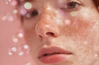 © EricMiguel - Close-up portrait of a freckled young woman's face with dewy skin, soft pink bubbles and delicate natural beauty - cosmetic and skincare detail