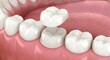 © ye - Tratamiento Protésico de Rehabilitación Oral con Corona en Molar Inferior