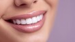 © NovaVision - Close-up of a woman's perfect white smile with glossy pink lipstick and healthy gums