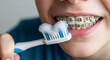 © Ekaterina - Teen boy brushing teeth with orthodontic toothbrush and braces