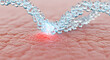 © Loki_Creo - Liquid drop moisture particle stream hitting red inflamed skin surface area for soothing hydration therapy treatment