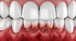 © Ahmad - Human Teeth and Inflamed Gums - Gum Disease Illustration