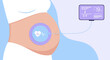 © kala - Fetal Monitoring: Pregnant Belly with Heartbeat Monitor and Display Screen