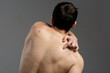 © skeronov - The young man's back is covered with pimples and signs of inflammation. The concept: men's health and untimely visits to the dermatologist, skin problems due to blood diseases and malnutrition