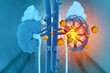 © Crystal light - Kidney stone disease. Renal colic. Human Urinary System. 3d illustration