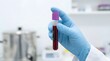 © Raj - Gloved hand holding blood sample test tube in laboratory, medical diagnostics and healthcare testing concept, clinical research and analysis in modern lab environment