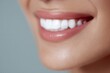 © Chandlerlikes - Woman smiling in dental studio closeup portrait with healthy white teeth