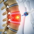 © MONIRUZZAMANKHAN - Spinal injection therapy