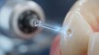 © DavoeAnimation - Close up of dental laser treatment on human tooth for cavity removal.