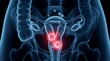 © guobao - 3D render of female reproductive system showing glowing red infected uterus with floating virus particles.