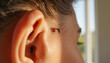 © Vera - Close-up of child's ear with stitches during recovery indoors