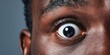 © NovaVision - Extreme close-up of a Black man's wide open eye showing detail and texture