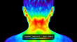 © Nguyen - Rear perspective of a human head and shoulder rendered with a vibrant thermal imaging effect highlighting heat signature variation and anatomical temperature zone on a dark backdrop.