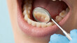 © praewpailyn - Dentist dental mouth teeth dental mirror dental exam Oral health checkup dentist clinic with dental mirror inside mouth showing teeth and gum care for hygiene, prevention, treatment, patient
