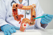 © kanruthai - Colorectal cancer, doctor holding intestine colon human anatomy model.