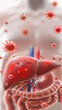 © pattozher - The Liver's Struggle: A medical illustration reveals a vivid depiction of a liver under assault from viral invaders. A somber reminder of the relentless challenges the human body faces.