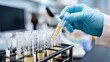 © StockHero - Close up of gloved hand placing blood-filled test tube into rack in laboratory setting