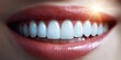 © NovaVision - Close-up of a perfect, healthy white smile with bright, shiny teeth and pink gums