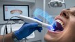 © Katsiaryna - Digital dental impression. Intraoral scanner capturing patient teeth and smile