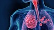 © tingyu - Lymphoma is a serious malignant disease of the human lymphatic system, causing swollen lymph nodes, recurrent fever, persistent fatigue and rapid weight loss. Abnormal lymphocyte proliferation impairs