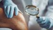 © Lemonkey - Close up of doctor examining patient knee with magnifying glass during consultation, representing healthcare, diagnosis, dermatology, rehabilitation, and medical treatment.