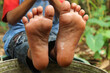 © Hendri - The wet and slightly dirty soles of a small child's feet indicate outdoor play. The background is a natural environment with a relaxed and natural atmosphere.