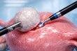 © Maryia - Laparoscopic myomectomy surgical 3D illustration shows graspers holding subserosal uterine fibroid while electrosurgical tool excises tumor from uterus surface, detailed gynecology procedure