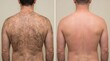 © Nora - Male Back Hair Removal Before and After Split Screen Concept